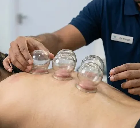 cupping therapy thubarahalli